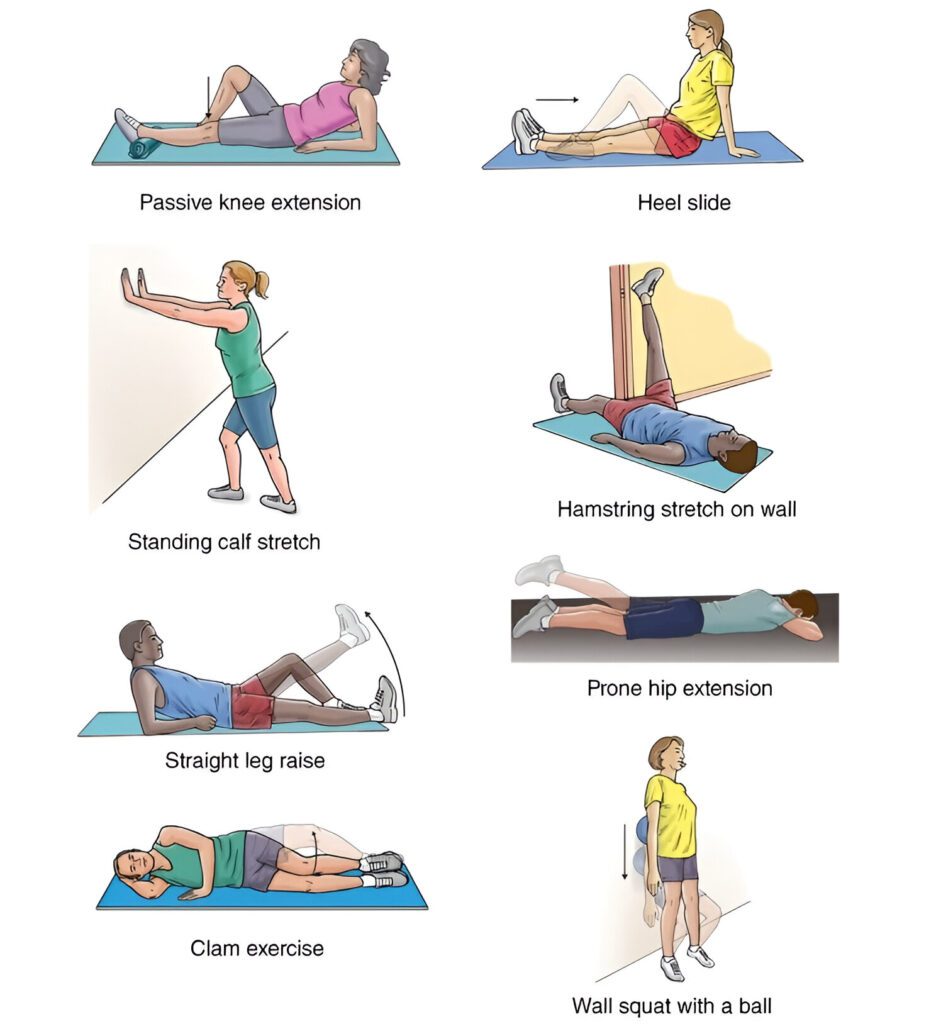  Knee Replacement Surgery - exercises